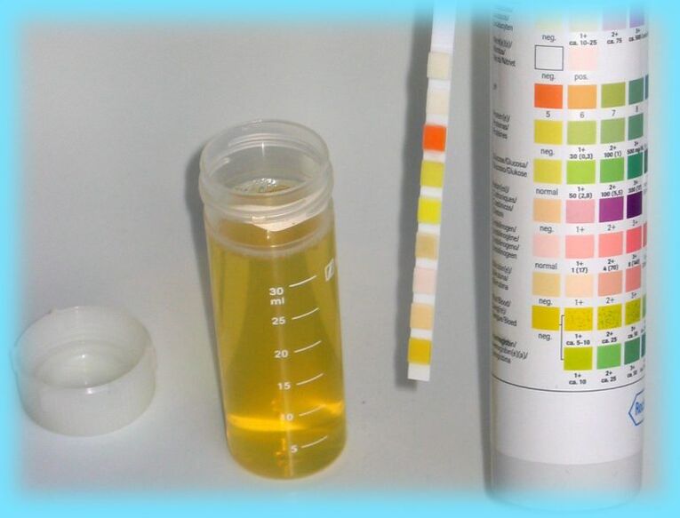 Analisis air kencing