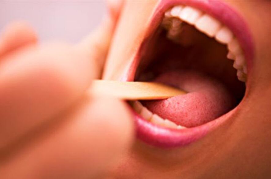 jenis parasit dalam mulut manusia